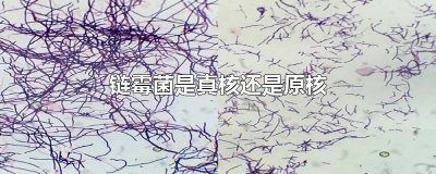 ​链霉菌是真核还是原核