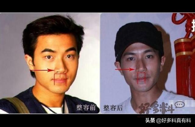 刘恺威整容对比照（网曝刘恺威前后对比照差别太大）(1)