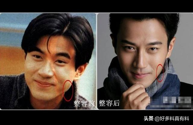 刘恺威整容对比照（网曝刘恺威前后对比照差别太大）(3)