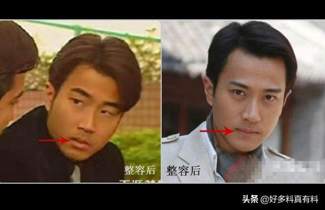 刘恺威整容对比照（网曝刘恺威前后对比照差别太大）(2)