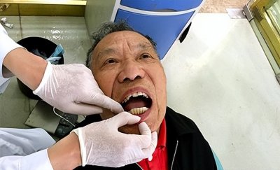 ​哪种活动假牙使用会更加舒服？