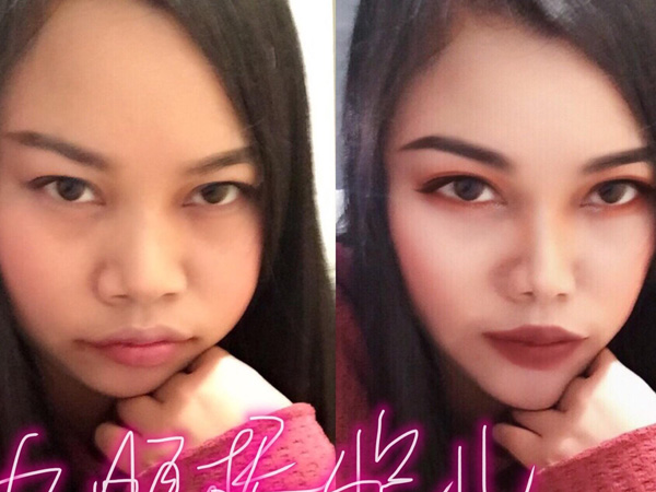 凤姐整容了吗?凤姐整容后照片对比,变化太大了