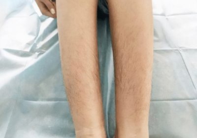 ​为什么有些女性体毛旺盛，有些却“光秃秃”？不妨来了解一下