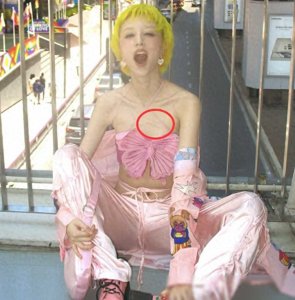 华晨宇女友瘦成纸片人,吊带露伤痕引关注,网友送祝福!